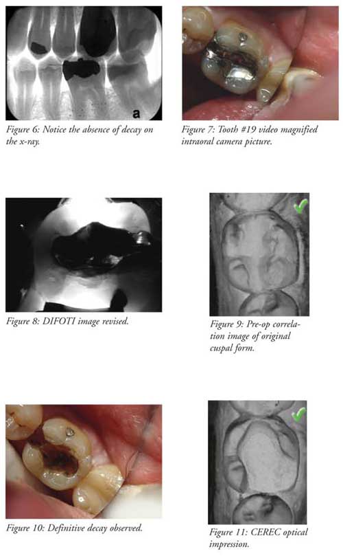 Antique Caroid Dental Powder Appointment - Antique Cars Blog
