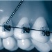 Lateral Incisors Widths