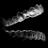 Can Invisalign Patients Access their Clinchecks?