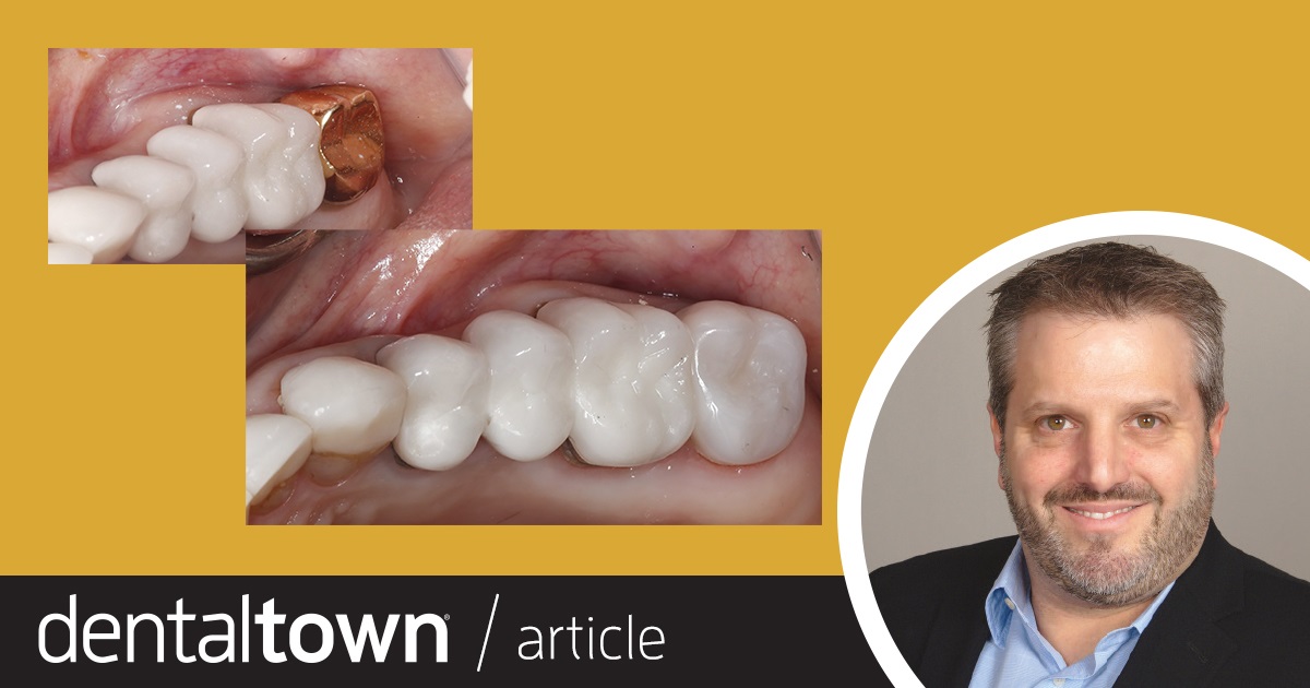 Show Your Work: Different Materials for Different Patients Dr. Richard Rosenblatt shares a case in which he created a zirconia crown in-house for a 60-year-old patient.