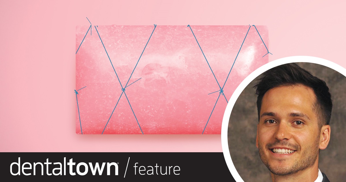Autogenous Soft Tissue Grafting  Two of the most common soft-tissue grafting techniques available today are connective tissue grafts and free gingival grafts. Periodontist Dr. David Paulson explains the distinguishing differences between the two in regard to indications and techniques, and how to determine which technique is more appropriate for each particular clinical situation.