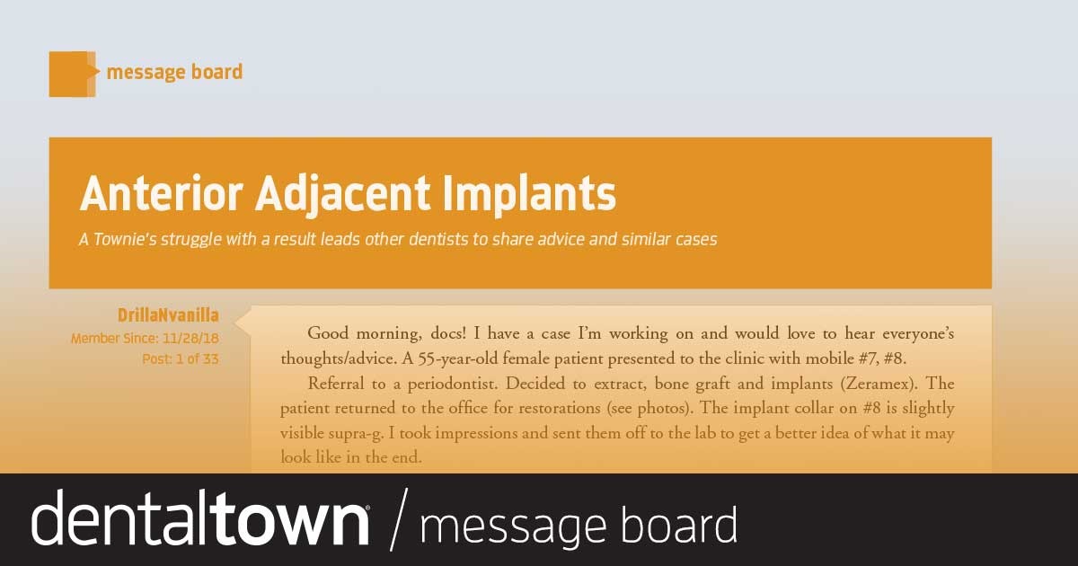 Anterior Adjacent Implants A Townie’s struggle with a result leads other dentists to share advice and similar cases