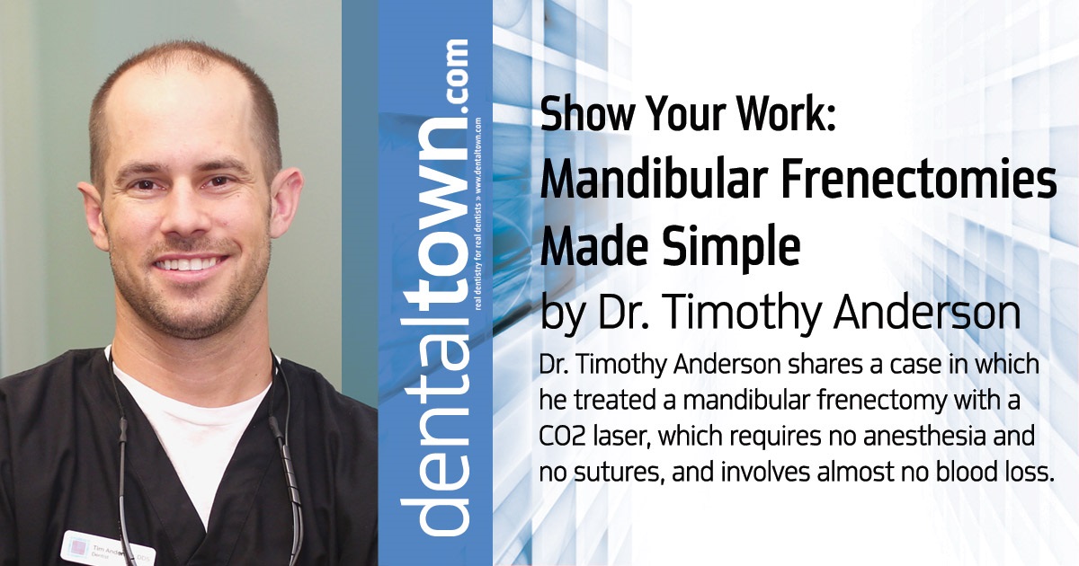 Show Your Work: Mandibular Frenectomies Made Simple Dr. Timothy Anderson shares a case in which he treated a mandibular frenectomy with a CO2 laser, which requires no anesthesia and no sutures, and involves almost no blood loss.