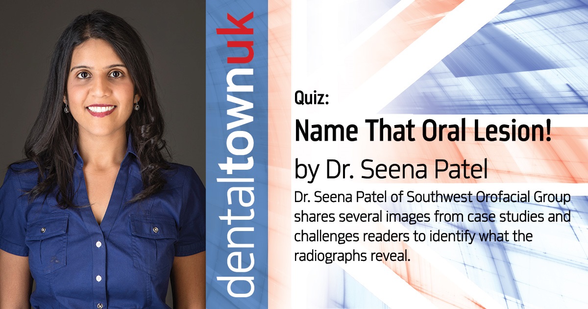 Name that Oral Lesion! Dr. Seena Patel’s shares several images from case studies and challenges readers to identify what the radiographs reveal.