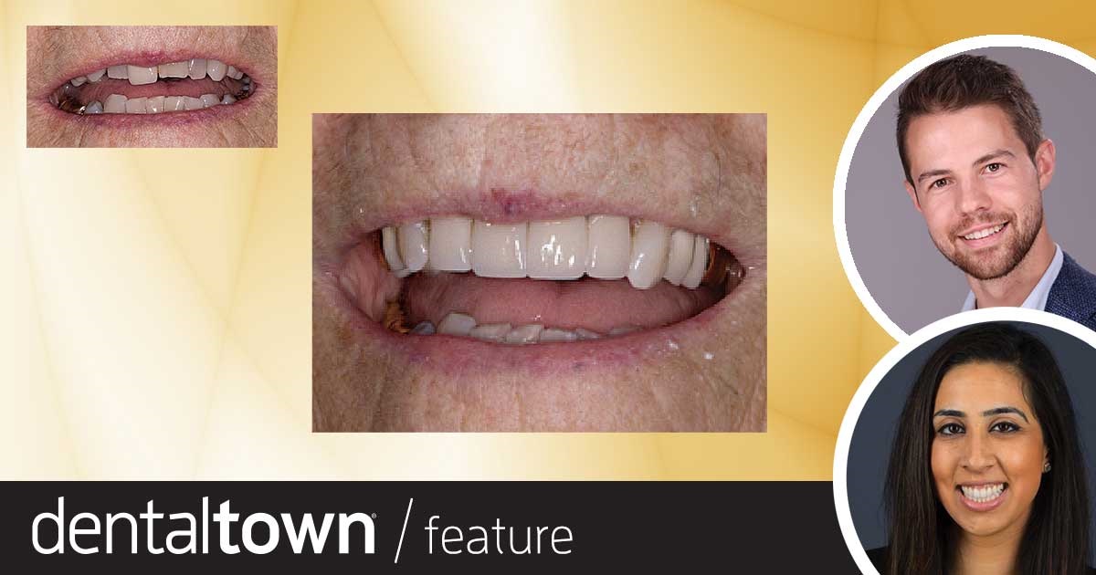 Show Your Work: Age Is Just a Number Dr. Sanna Charlie and fourth-year dental student Christofer Hatzis share a case study in which they used minimally invasive dental measures to restore the aesthetics to the smile of a 92-year-old patient.