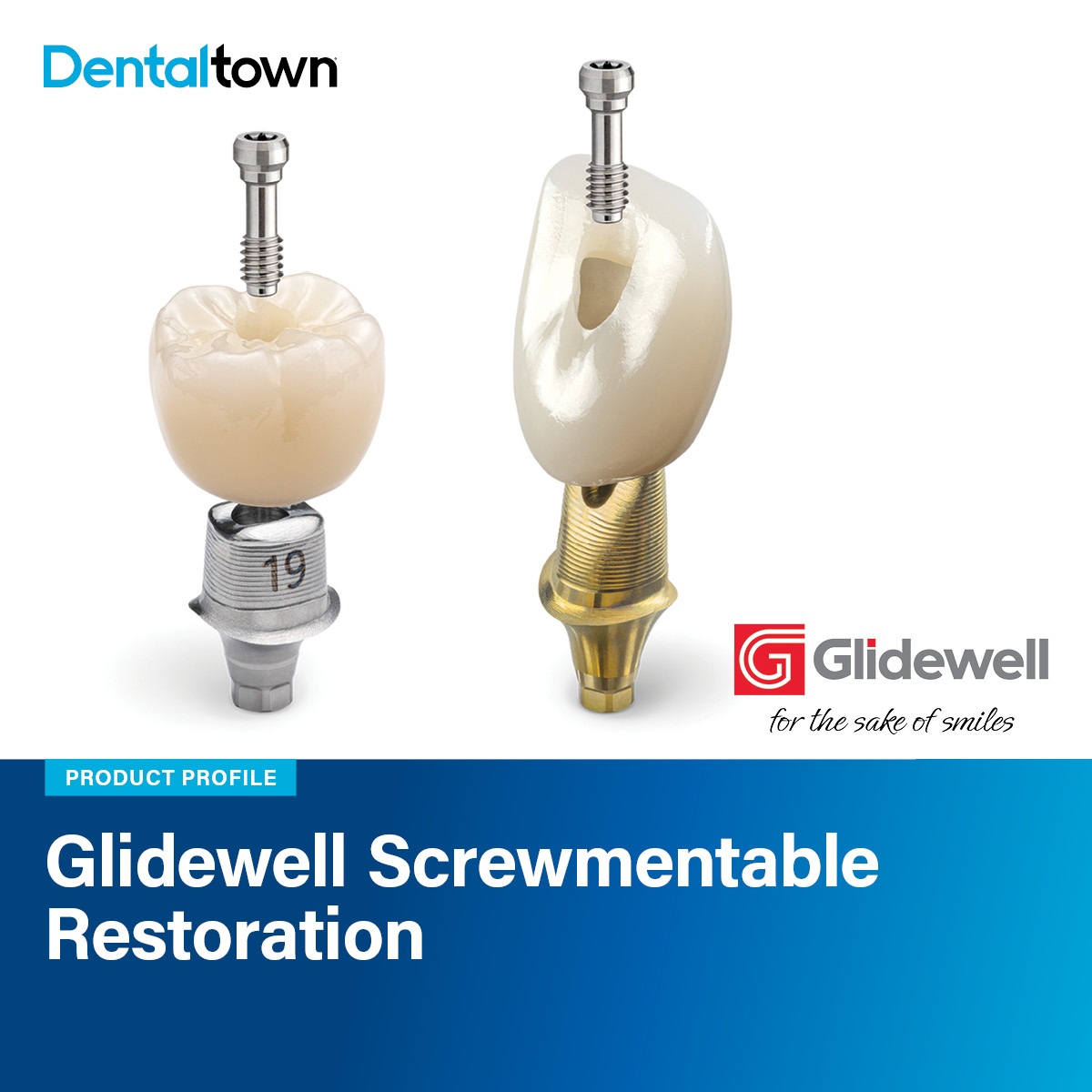 Product Profile: Glidewell Screwmentable Restoration Simplify implant delivery while elevating clinical and aesthetic outcomes.