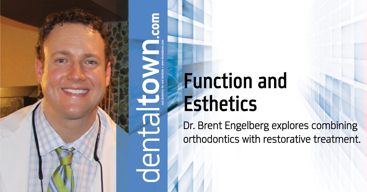 Function and Esthetics  of Lithium Disilicate  Restorations Dr. Brent Engelberg explores combining orthodontics with restorative treatment.
