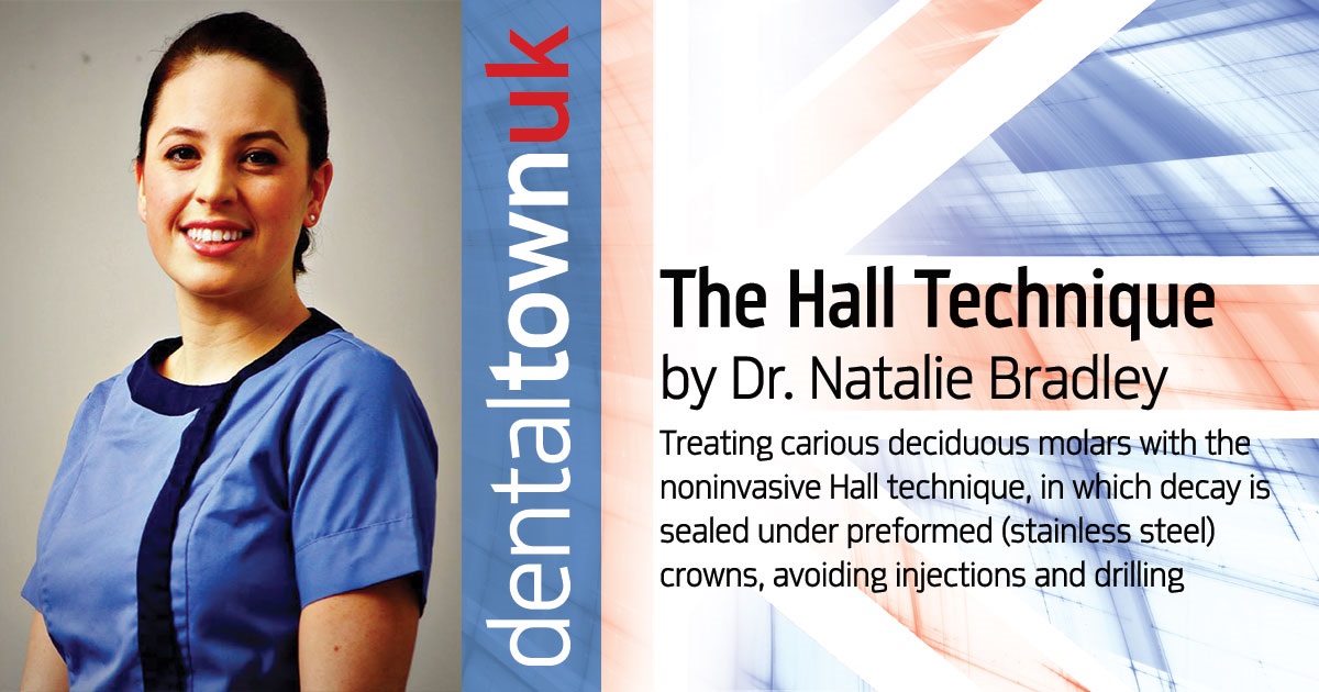 The Hall Technique Dr. Natalie Bradley treats carious deciduous molars with the noninvasive Hall technique, in which decay is sealed under preformed (stainless steel) crowns, avoiding injections and drilling.