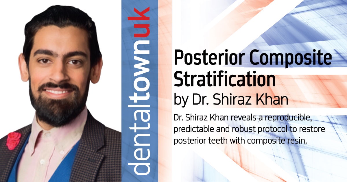 Posterior Composite Stratification: A Clinical Case Report Dr. Shiraz Khan reveals a reproducible, predictable and robust protocol to restore posterior teeth with composite resin.