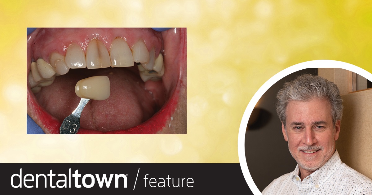 Show Your Work: Revitalizing Restorations in Seniors Dr. Robert Rosenfeld shares two case studies that illustrate a growing trend in geriatric dentistry: patients who are looking for high-quality aesthetic restorations but whose teeth have darkened with age.