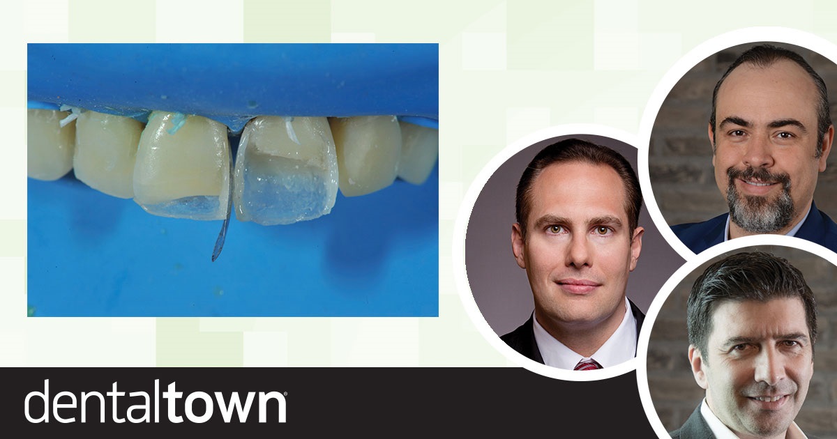 Face Forward One of our most-followed Townies, Dr. Arthur R. Volker, and two colleagues explain matrixing strategies for anterior and facial surfaces, discuss the indications and pros and cons of each option, and share case studies that illustrate the principles involved.