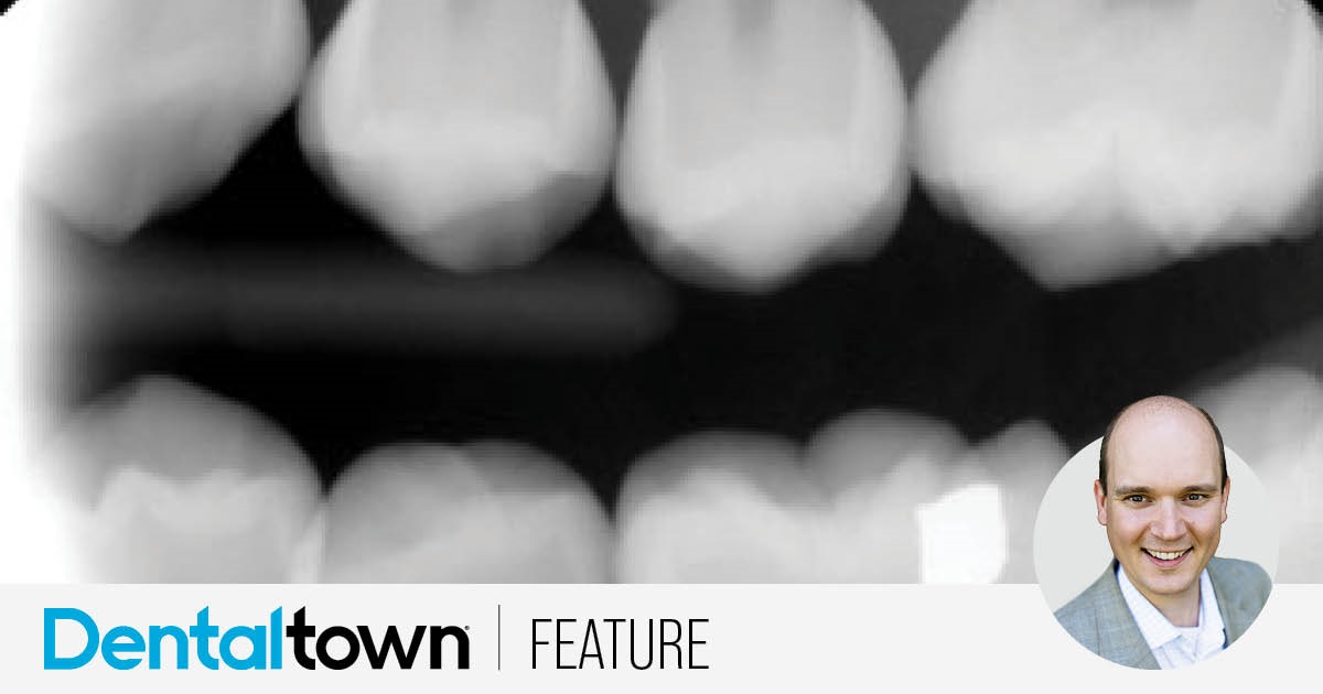 Second Opinion: The Tooth the Dentist Rejected Dr. Jarod Johnson discusses when early extraction of permanent first molars can be appropriate for pediatric patients and shares a case study illustrating the principles behind the decision.