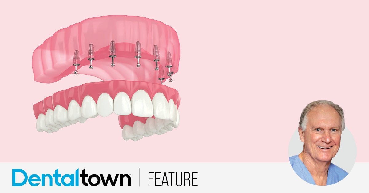 A Partially Analog Approach Dr. Emil M. Verban Jr. explains which key factors must be evaluated when determining which prosthetic design should be used for optimal success in implant dentistry, and shares a case study involving guided placement of implants to support an all-on-X maxillary prothesis.