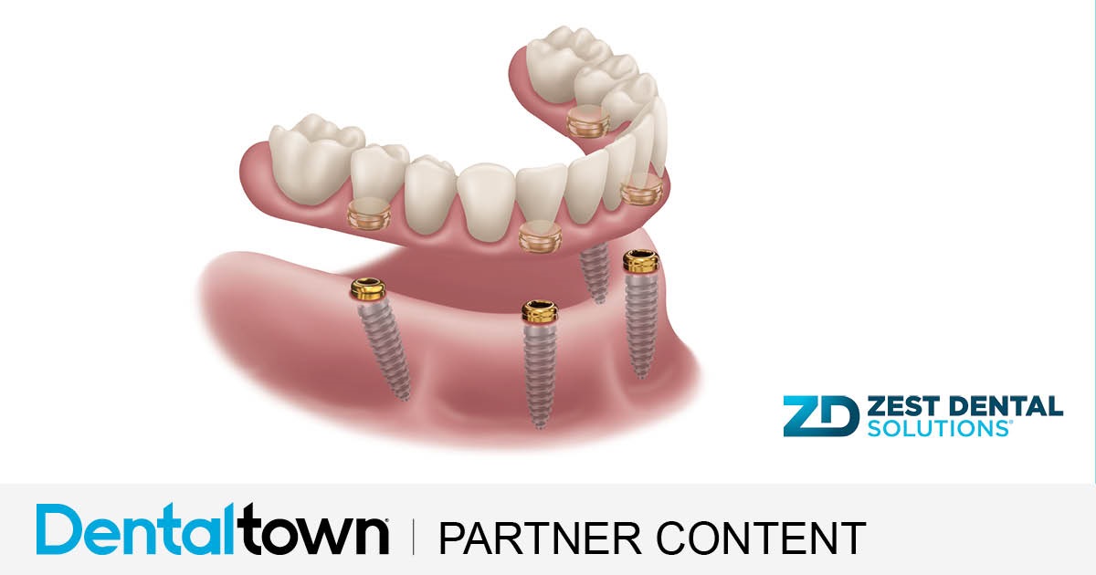 Product Profile: Locator Angled Abutment More flexibility, more patients, same trusted system