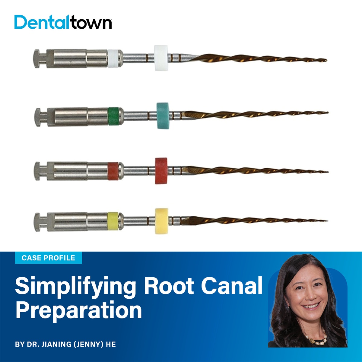 Case Profile: Simplifying Root Canal Preparation Dr. Jianing (Jenny) He walks through a simpler approach to root canal preparation using EdgeOne Blaze Utopia.