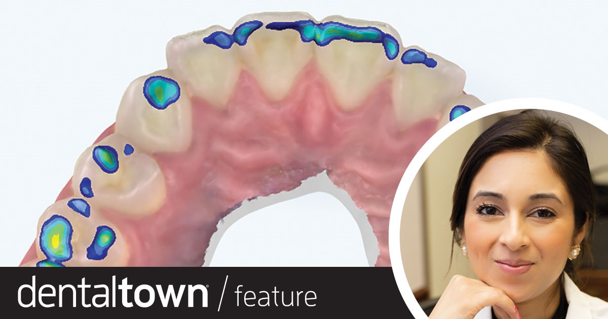 Show Your Work: Dental Restorations — Building Better Bonds  Dr. Hemali Ajmera recaps the options available for aesthetic dental restoration of malformed, misshapen or underdeveloped lateral incisors, and shares the step and details behind a same-day chairside treatment she performed for a patient who wanted a painless option to treat her short incisors.