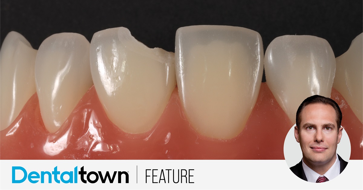 The ‘Blank Canvas’ Technique Dr. Arthur R. Volker, one of the most-followed members on Dentaltown’s message boards, discusses a technique that can help dentists provide an expedited polychromatic restoration for small fractures, emergency cases or pediatric patients.