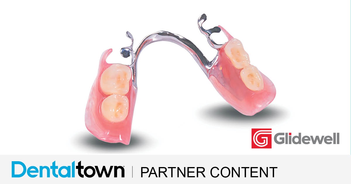 Product Profile: Glidewell Simply Natural Partials The SLM method: A better fit for partial dentures