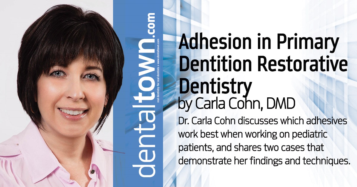Adhesion in Primary Dentition Restorative Dentistry Dr. Carla Cohn discusses which adhesives work best when working on pediatric patients, and shares two cases that demonstrate her findings and techniques.