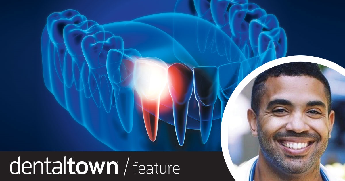 A Fine Place To Start Dr. LeRoy Horton shares a case that illustrates immediate dental implant placement on the mandibular first molar, which he considers to be an ideal site for clinicians to begin immediate implant practice.