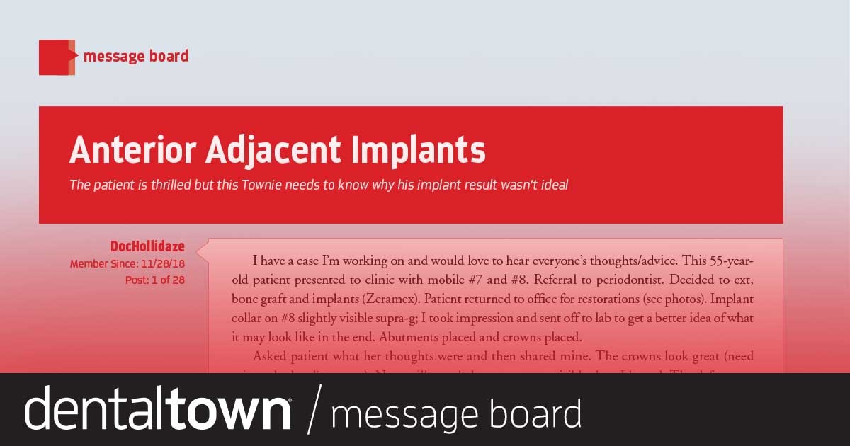 Anterior Adjacent Implants While the patient is happy with the outcome, this Townie looks for answers as to why this implant result wasn’t more ideal.