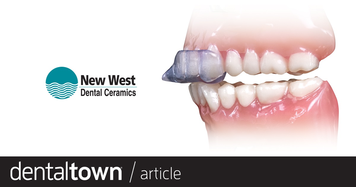 Product Profile: NTI-tss Plus Reduce clenching intensity and prevent migraines