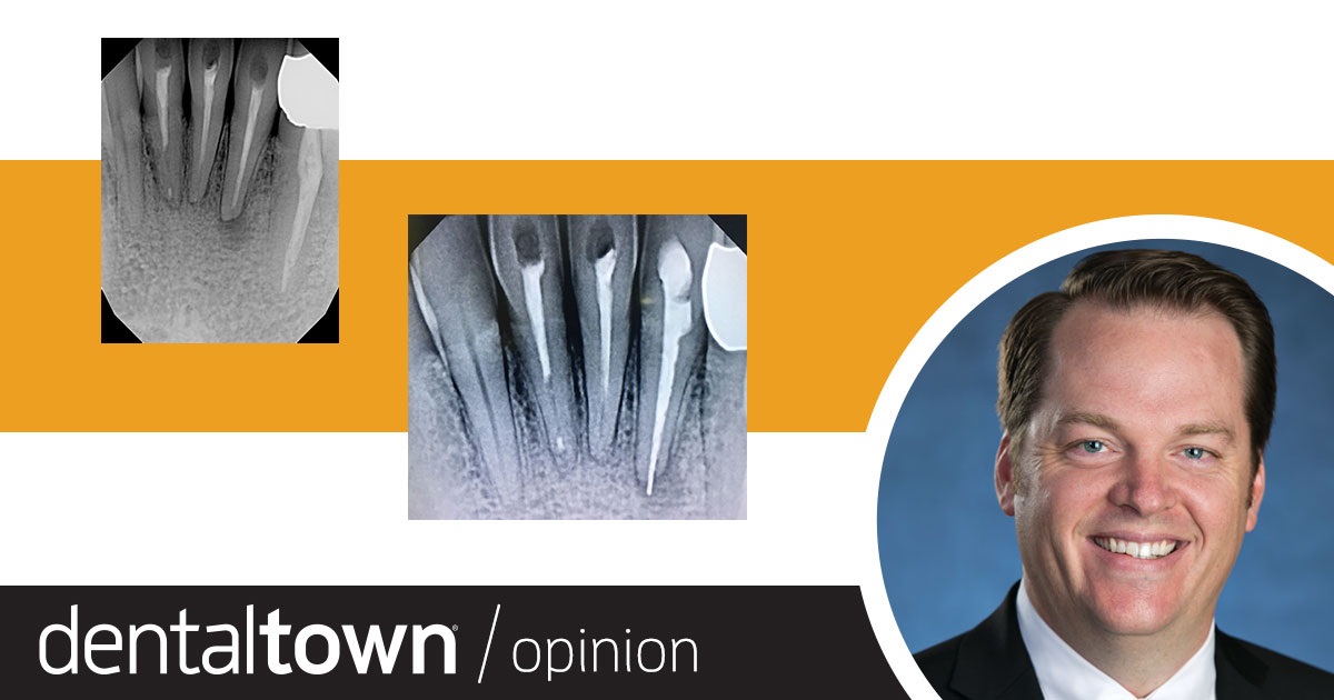 Professional Courtesy: Specialists Aren’t Perfect Dr. Thomas Giacobbi, Dentaltown’s editorial director, recently referred his friend to an endodontist and the subsequent treatment was far from perfect. How do you communicate expectations when referring patients, and friends, to a specialist?