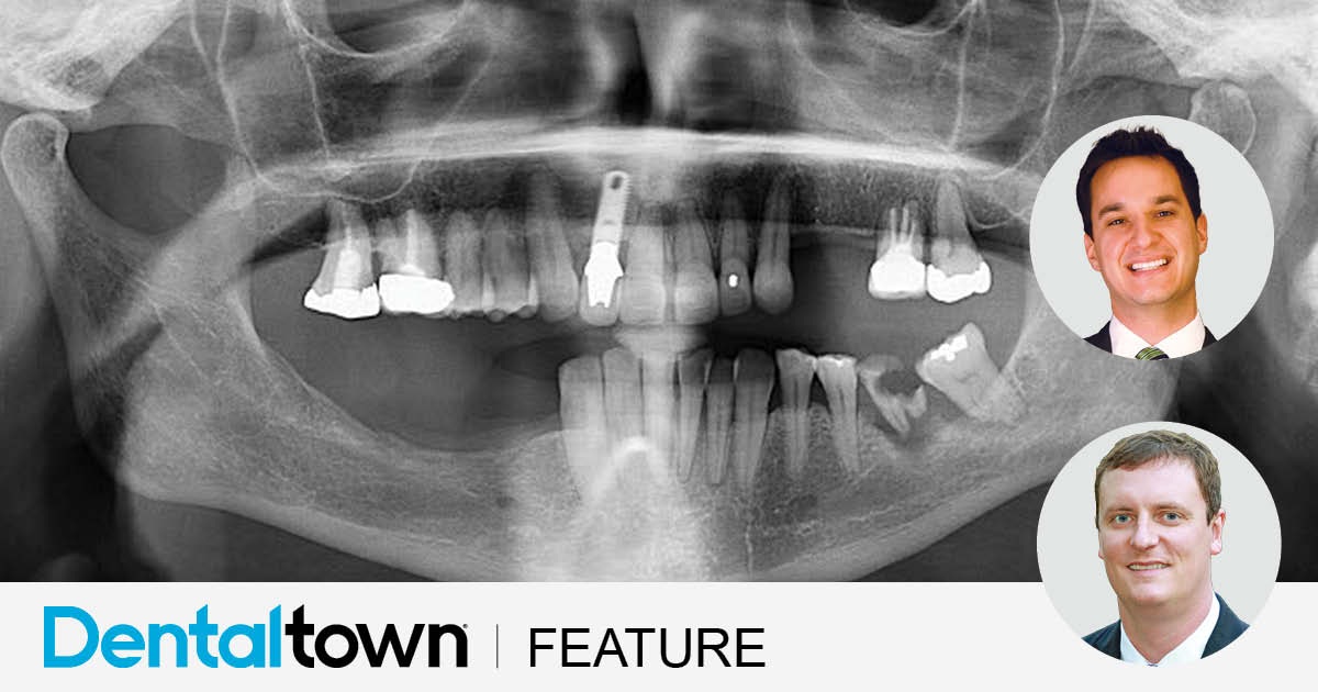 Rescuing a Failed Maxillary Arch with a Pterygoid Implant: A Digital Full-Arch Success Story A failed implant nearly derailed this full-arch case from Drs. Danny Domingue and Cory Glenn—until a digital workflow and pterygoid rescue saved the smile and exceeded patient expectations