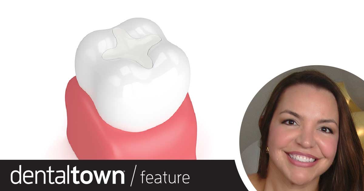 Glass Ionomer Cement Sealants Dentaltown editorial advisory board member Dr. Jeanette MacLean discusses why glass ionomer cement sealants are easier for clinicians and better for patients, then explains the application techniques and key benefits.