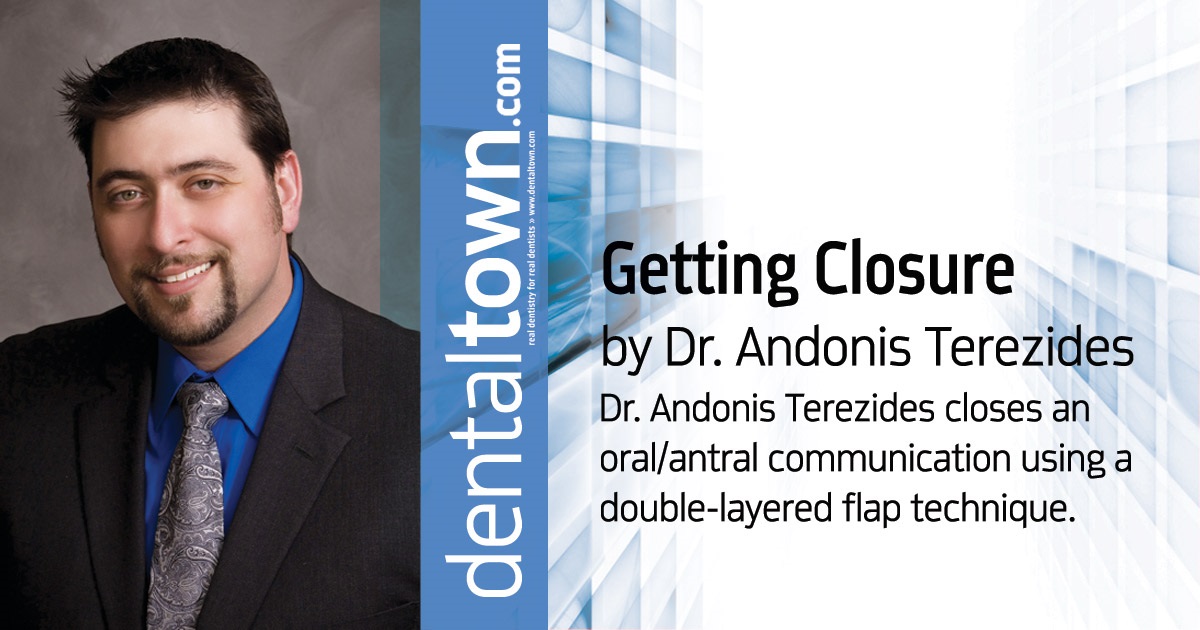 Getting Closure Dr. Andonis Terezides closes an oral/antral communication using a double-layered flap technique.