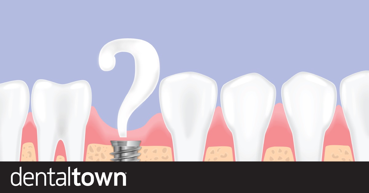 What Is Holding You Back from Placing Implants in Your General Practice?   Townies discuss when and whether placing implants is worth it.