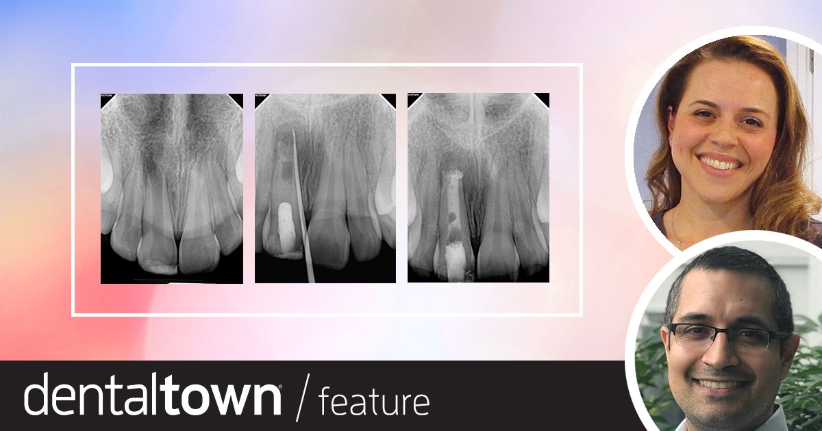 Redefining  ‘Success’ With  Regenerative Endo Drs. Judy McIntyre and Nikhil Mallick discuss regenerative endodontics and the need to reconsider what’s considered a “successful treatment” in some cases related to traumatic injury of pediatric patients.