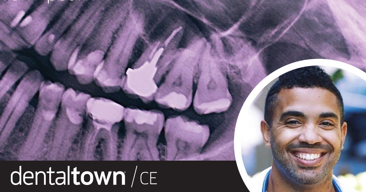 Dental CE: Setting the Tone: Guided Bone Regeneration Techniques Dr. LeRoy Horton’s latest implants CE course for Dentaltown delves into beginning-level guided bone regeneration, discussing specific strategies that will aid in surgical, restorative and aesthetic success.