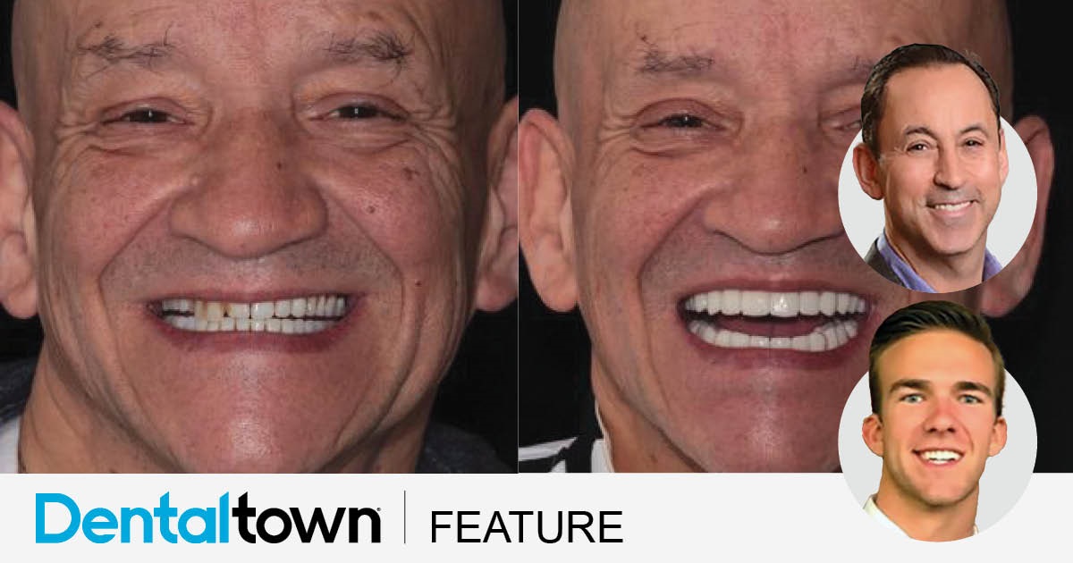 Show Your Work: Bytes Create Bites Dr. Steven Glassman and Ryan Wagner share a case study that involved a digital workflow to create a new denture for a patient who’d fractured his old one.
