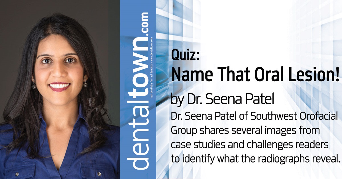  Name that Oral Lesion! Dr. Seena Patel of Southwest Orofacial Group shares several images from case studies and challenges readers to identify what the radiographs reveal.