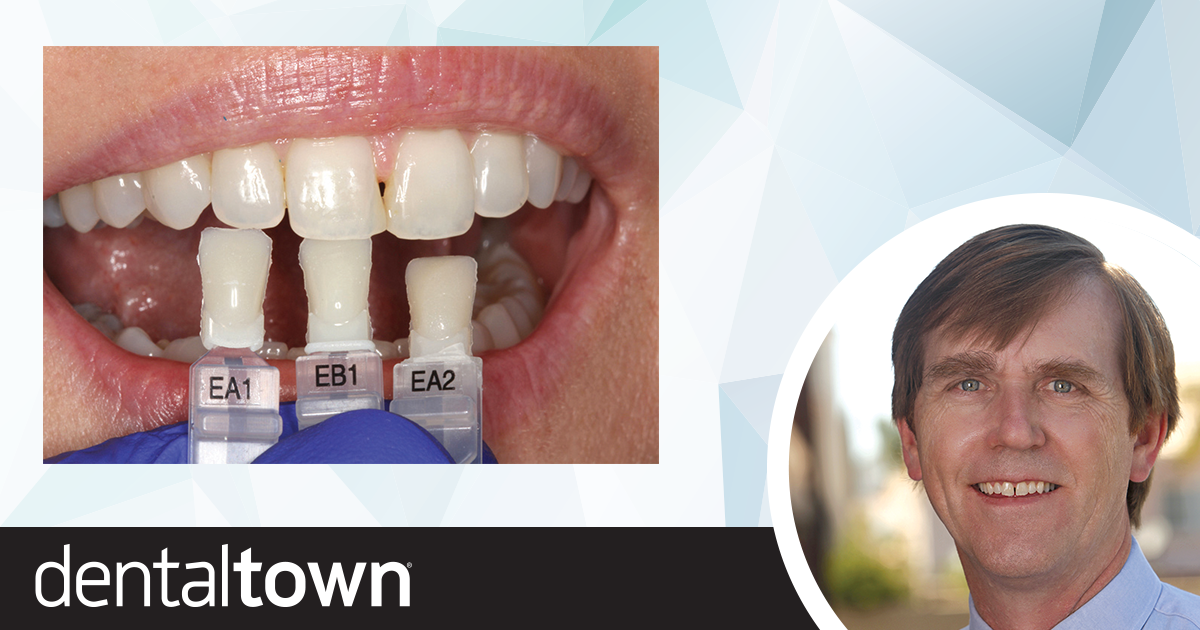 A Predictable Way to Close the Gap Dr. James Peyton shares a case study about a simple way to close a diastema. 