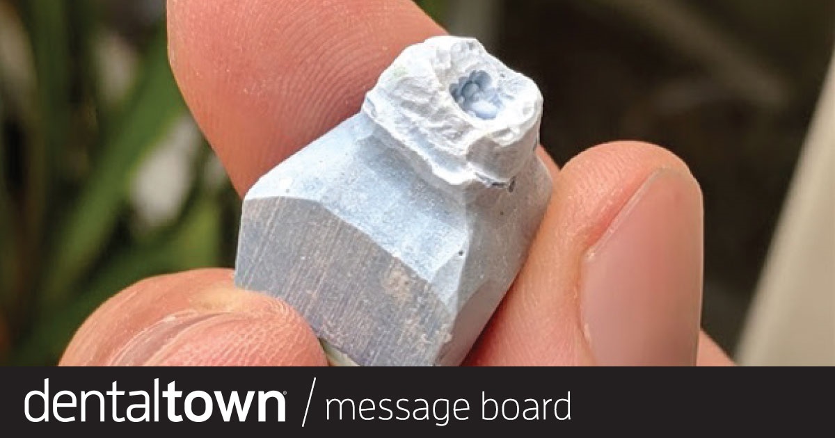 Idiot Proof Crown Prep? Trying to  Come Up With One.   The Townie community comes to the rescue with tips to improve lab work.