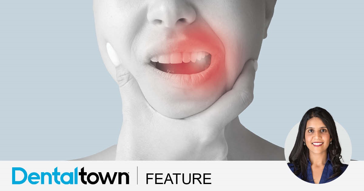 What a Pain! Dr. Seena Patel shares multiple case studies in which readers are challenged to identify the likely source of pain in a tooth that shows no signs of dental, pulpal or periodontal pathology.