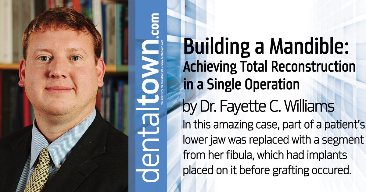 Building a Mandible Achieving Total Reconstruction in a Single Operation