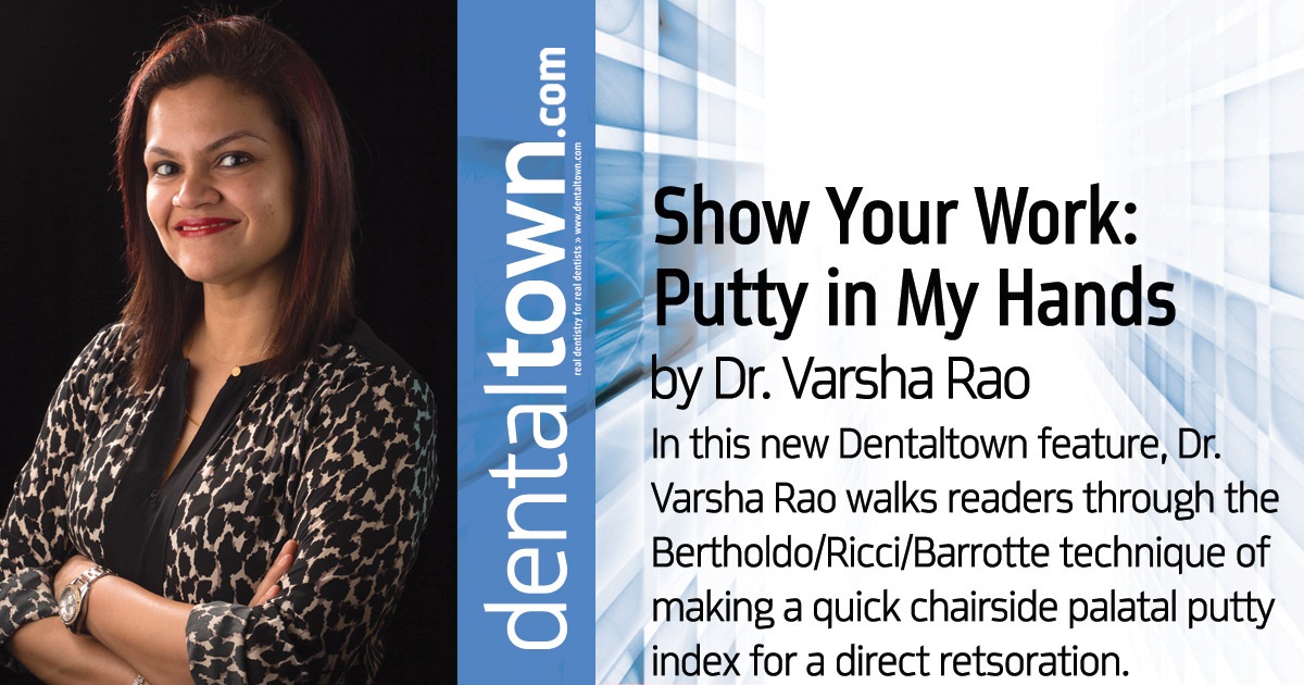 Putty in My Hands Direct Restoration in the Anterior Teeth Using Two Techniques