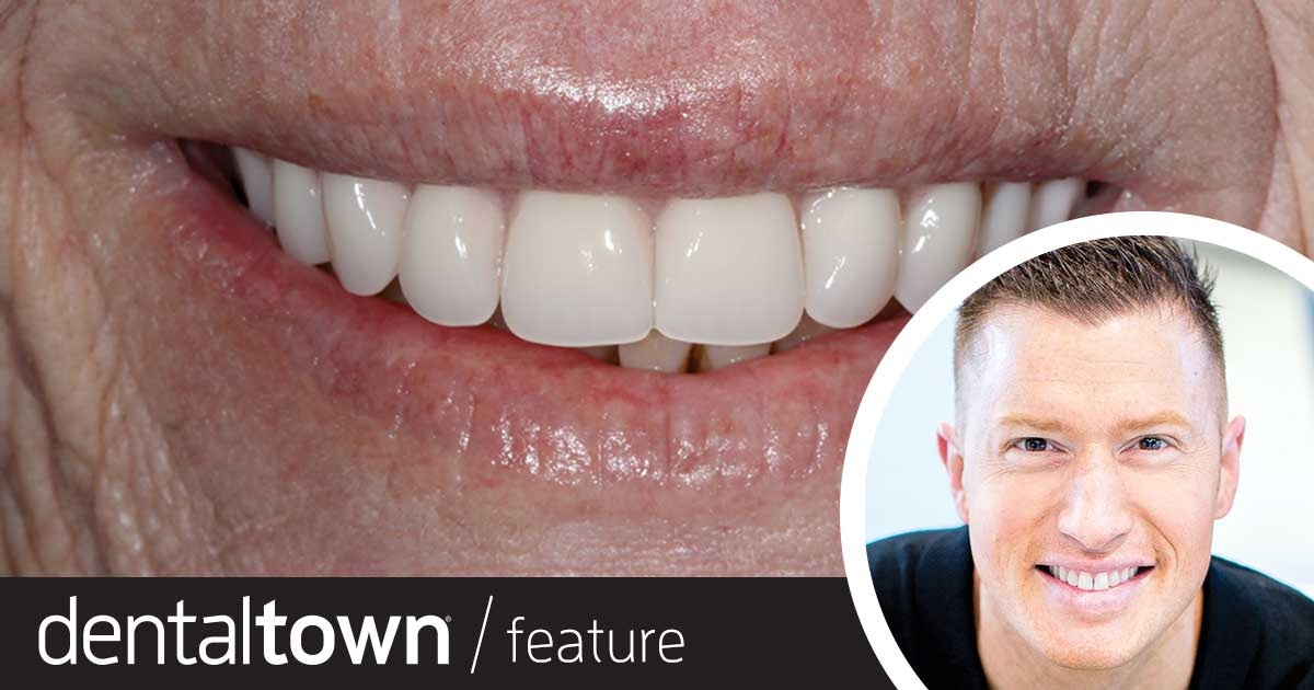 Creating an Affordable, Aesthetic Same-Day Full-Arch Prosthetic Dr. Grant Olson explains the technology and simplified restorative protocols that help dentists create same-day, immediate-load implant-retained prosthetics that are strong, aesthetic and cost-effective.