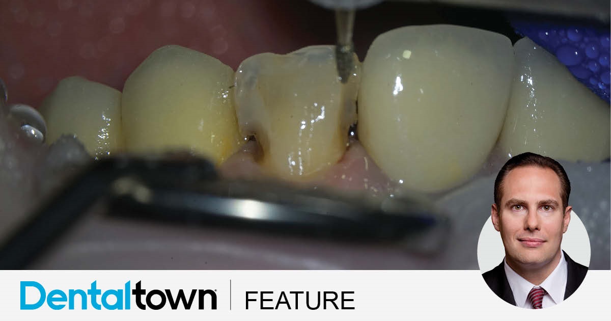 Show Your Work: Strike Up the Band! One of our top-followed Townies, Dr. Arthur R. Volker, shares a case study that illustrates how to use a dental matrix with the composite injection-molding technique to create a patient’s full-contour veneers. 