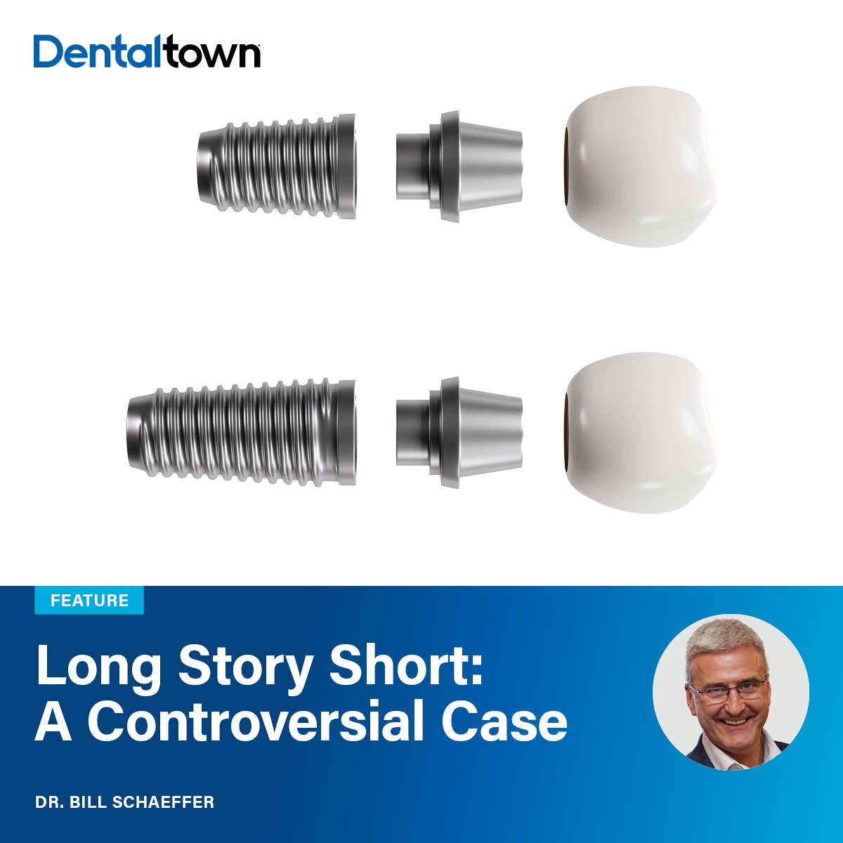 Long Story Short: A Controversial Case Dr. Bill Schaeffer revisits a once-criticized short implant case now thriving after 15 years 
