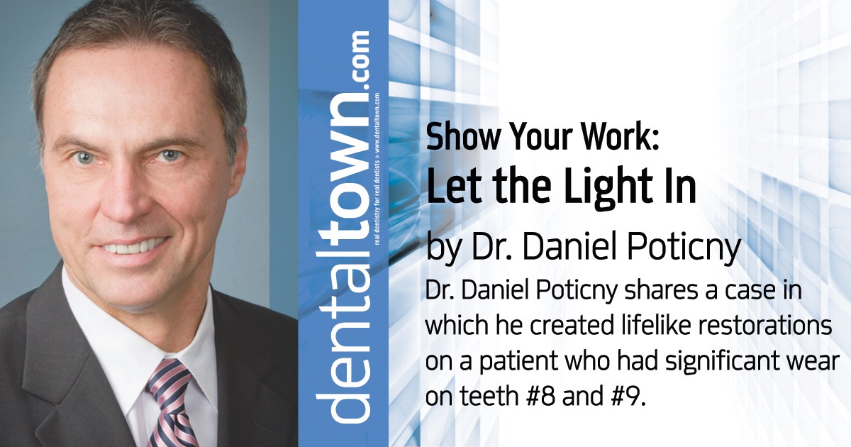 Show Your Work: Let the Light In Dr. Daniel Poticny shares a case in which he created lifelike restorations on a patient who had significant wear on teeth #8 and #9.