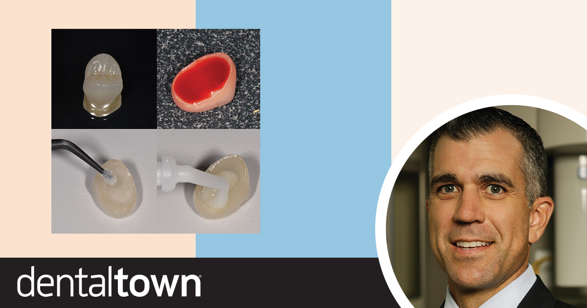 Cementation and Bonding Dr. Chad Duplantis discusses clinical indications and procedures for cementation on different types of materials.
