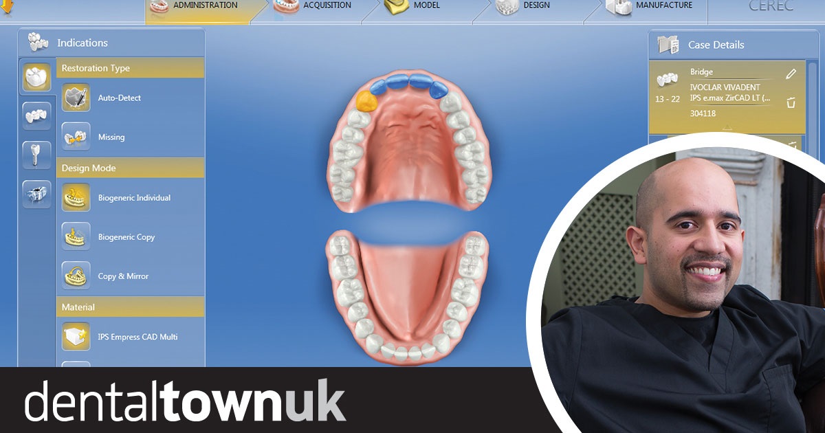 Show Your Work: Guided Implant Surgery (Part 2) Dr Alif Moosajee discusses how he uses digital planning to predictably place implants in their optimal position.