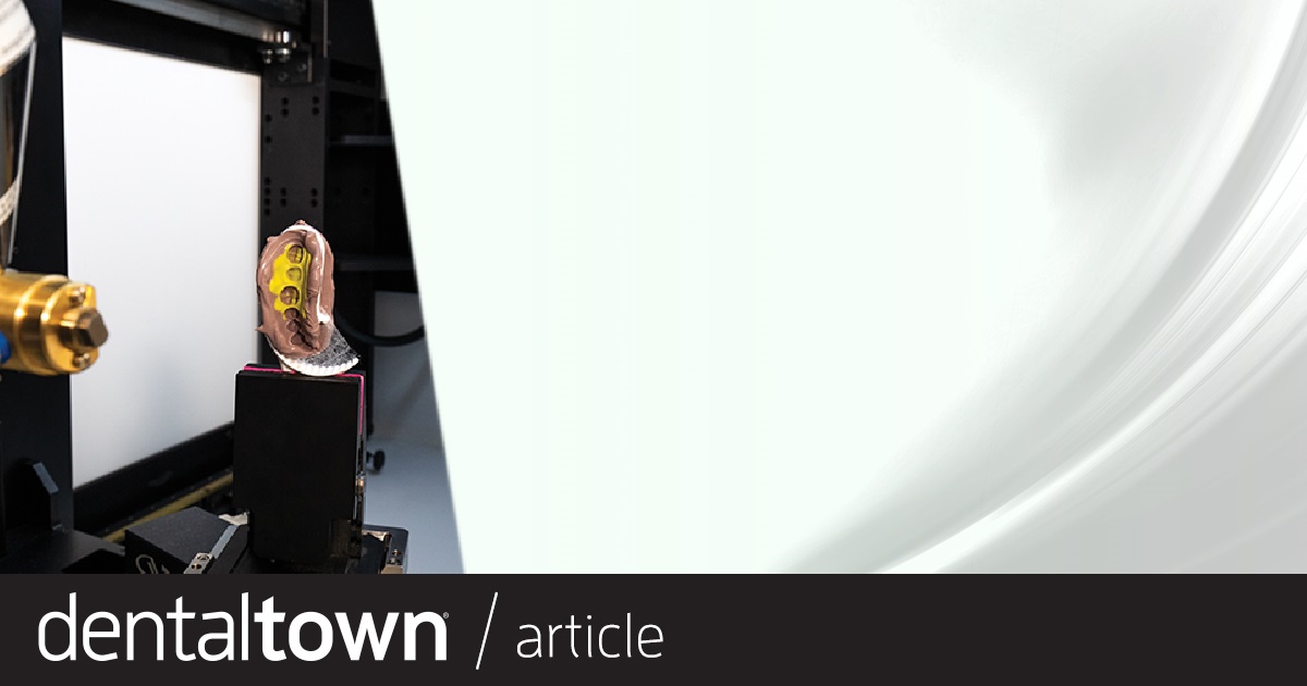 Industry Insights: The Digital Dental Lab Has Arrived A look at how CT scanning and model-free cases are the future of dentistry, and how lab companies are investing heavily in that future.