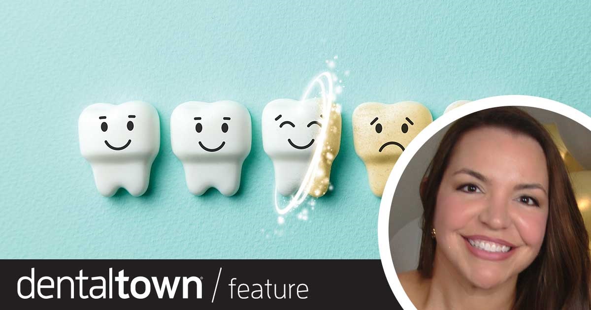 Whitening Emulsions: A Case Study Dr. Jeanette MacLean shares a case study and assessment of the latest entry into the field of over-the-counter whitening products—brush-on emulsions.