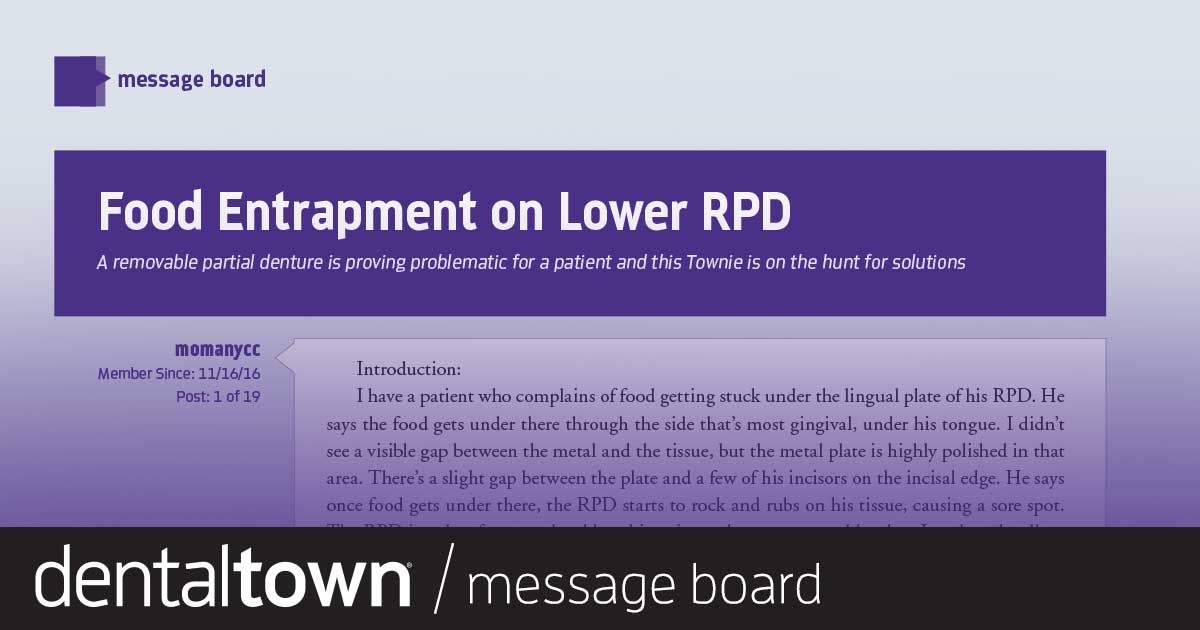 Food Entrapment on Lower RPD A removable partial denture is proving problematic for a patient and this Townie is on the hunt for solutions