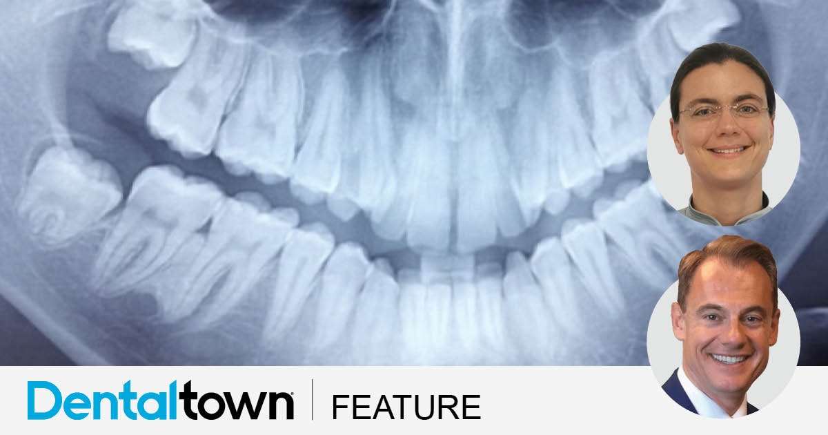 Clinical Case Spotlight: Nonsurgical Underbite Treatment Drs. Anthony D. Viazis and Evangelia Dartzalopoulou discusses a patient case in which a general dentist treated a patient’s complete underbite in centric occlusion using only brackets and an archwire. 